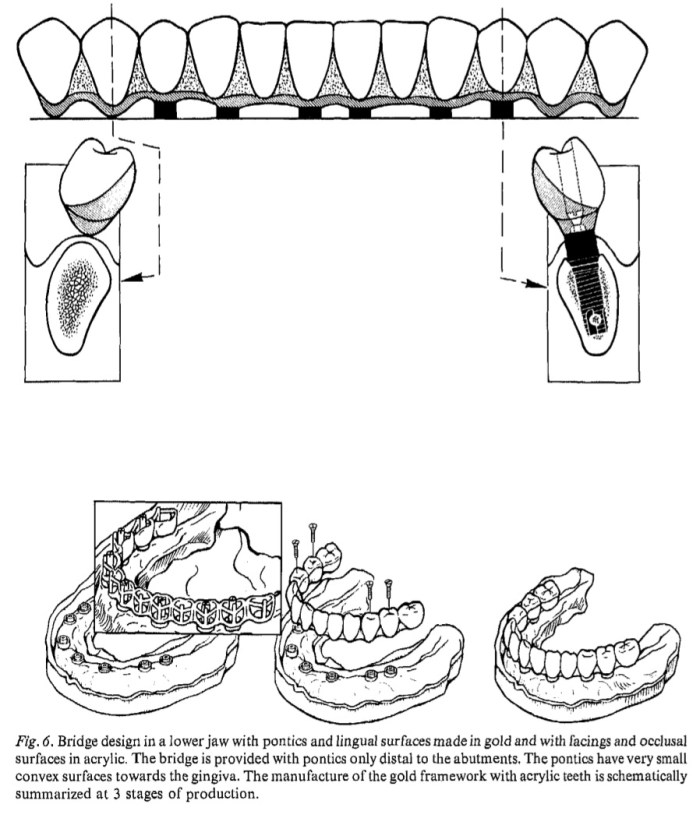 Int J Oral Surg 1981 Vol.10-7