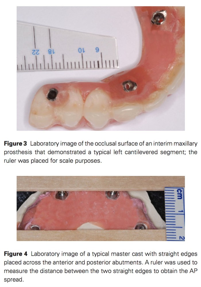 J Prosthodontics 2017 Vol.26-2